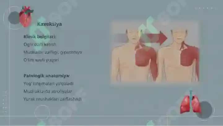 Ovqatlanish va tashqi muhit ta'sirlari bilan bog'liq bo'lgan kasalliklar 4