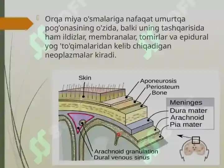 Orqa miya o’smalari 2