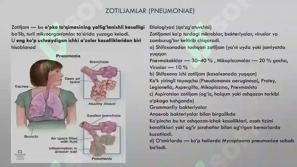 OPKA TOQIMASINING (ZICHLASHISH) SINDROMI 3