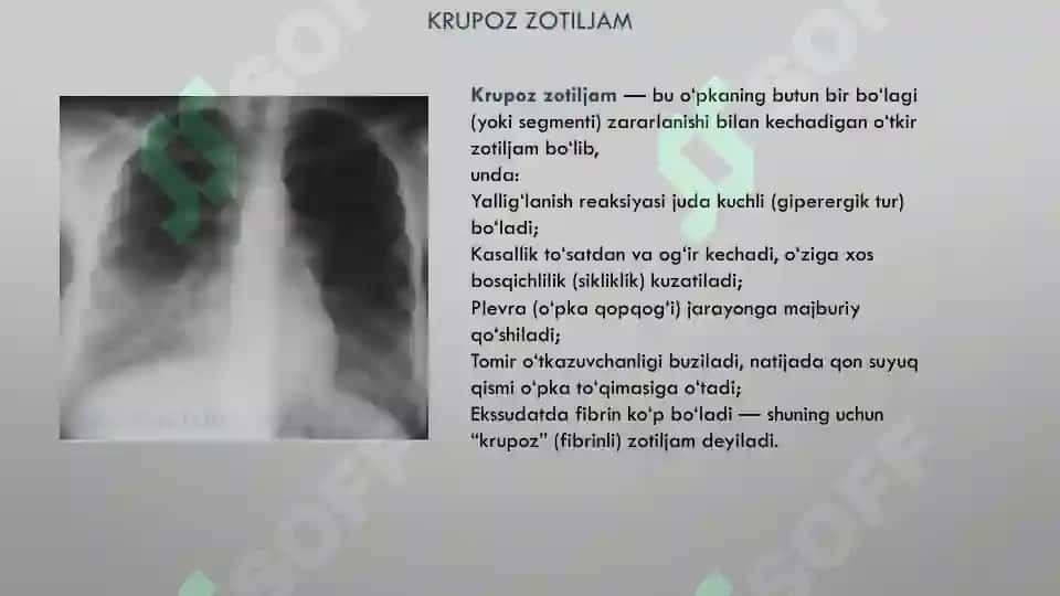 OPKA TOQIMASINING (ZICHLASHISH) SINDROMI 8