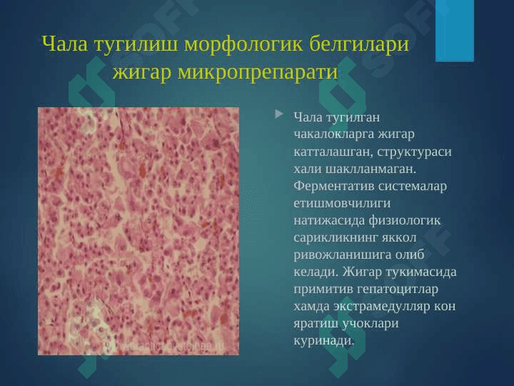 Перинатал патология 7