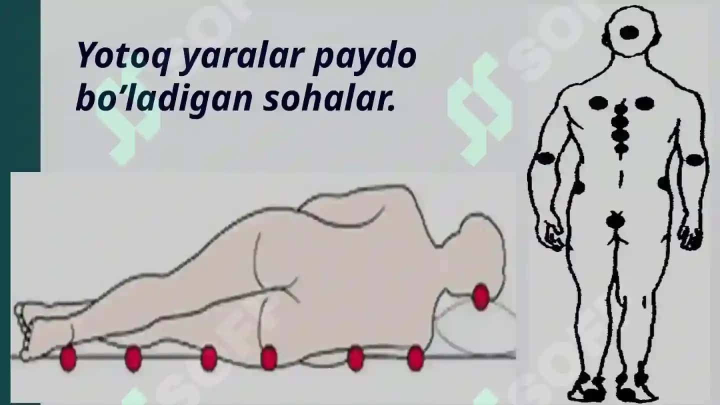 Yotoq yaralar haqida batafsil ma'lumotlar. 4