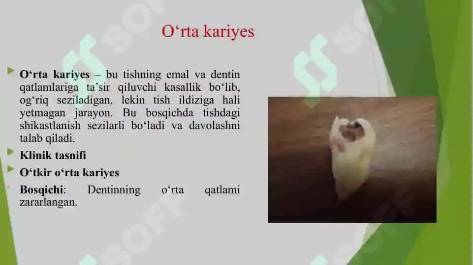 O'RTA KARIYES.O'TKIR VA SURUNKALI SHAKLLARINI KLINIKASI, QIYOSIY TASHXISI. KASALLIK TARIXINI YOZISH. 3