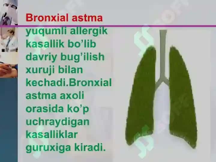Bronxialastma 2