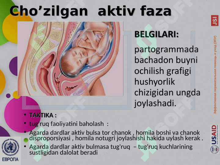 Qoniqarsiz tug’ruq faoliyati.Yelkalar distostiyasi2 7