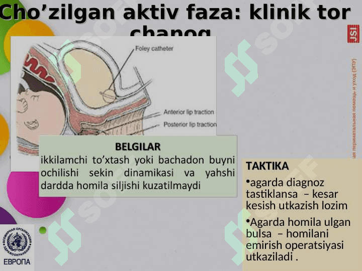 Qoniqarsiz tug’ruq faoliyati.Yelkalar distostiyasi2 8