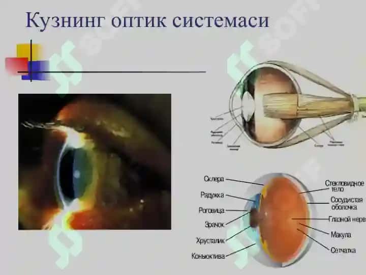 Клиник рефракция. Рефракция аномалияларини диагностикаси 2