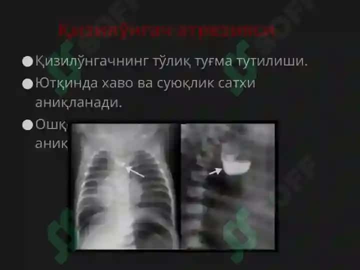 Қизилўнгач 7