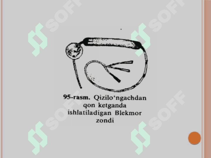 Qon ketishni vaqtincha va batamom to'xtatish usullari 4