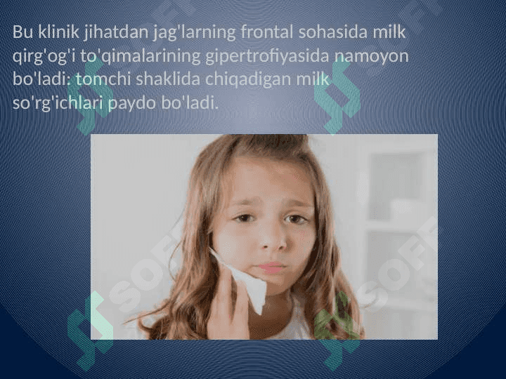Yuvenil gingivit 3