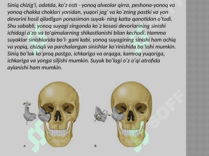 Yonoq yoyi va
 suyagini sinishi 4