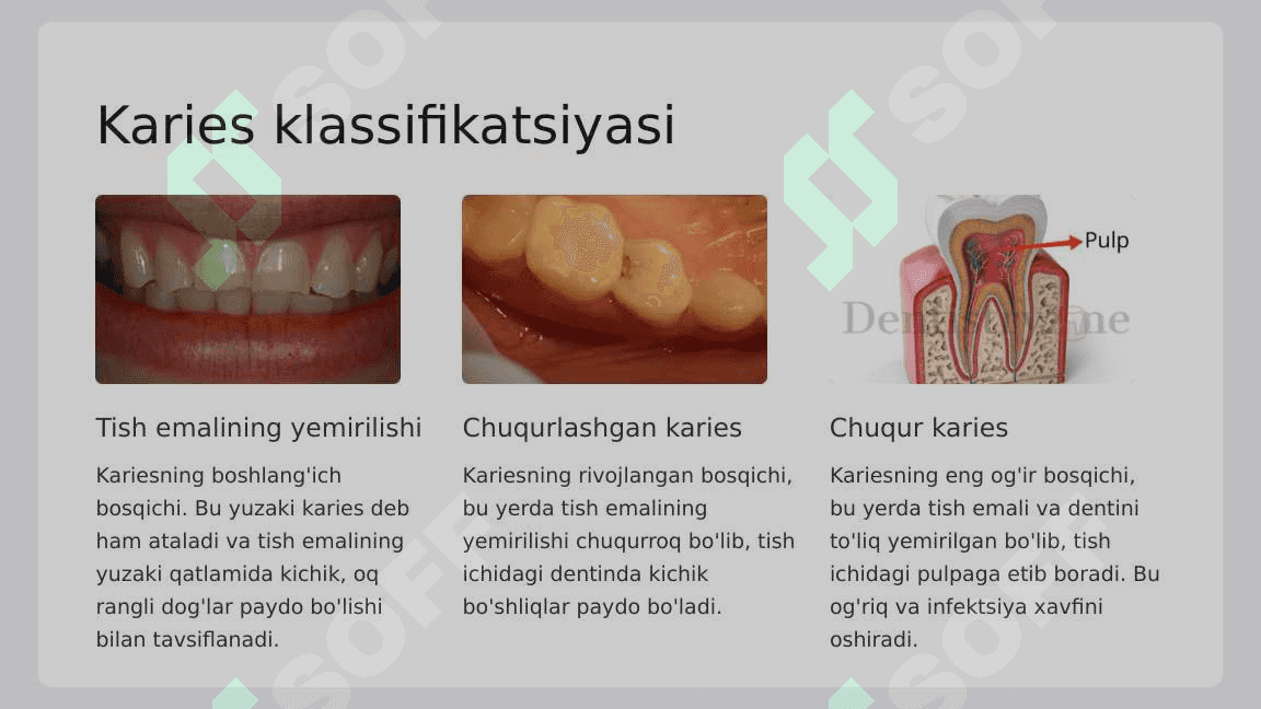 Chuqur karies.  O‘tkir va surunkali  shakllarini klinik  kechishi,  tashxislash, qiyosiy  tashxisi. Fizikaviy  tekshirish usullari  (termoelektroodonto  diagnostika). 3