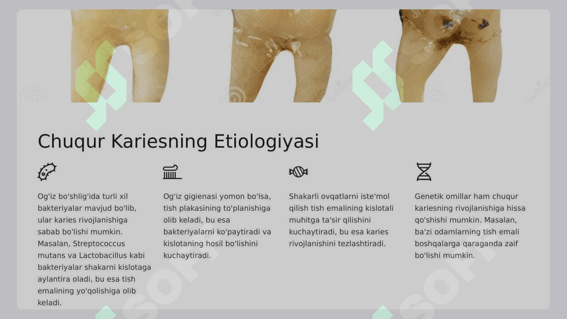 Chuqur karies.  O‘tkir va surunkali  shakllarini klinik  kechishi,  tashxislash, qiyosiy  tashxisi. Fizikaviy  tekshirish usullari  (termoelektroodonto  diagnostika). 4