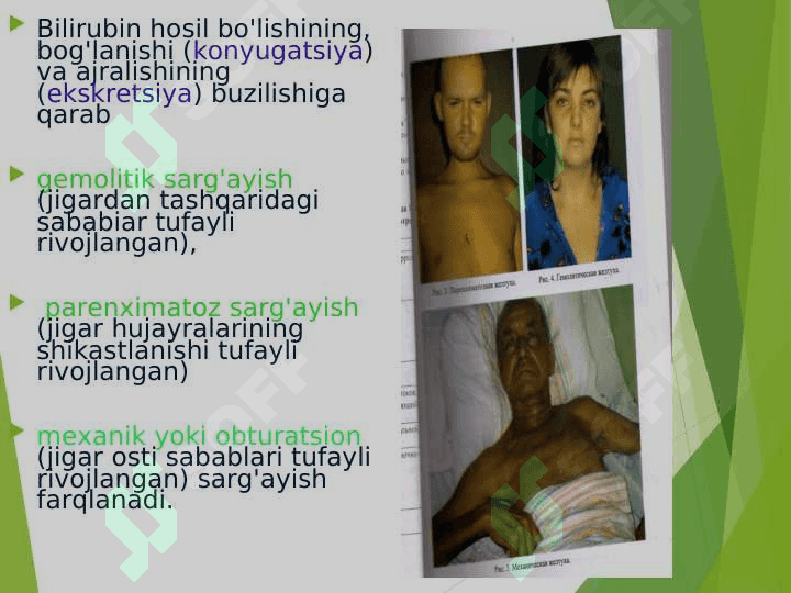 JIGAR VA O'T YO'LLARI SISTEMASI SINDROMLARI. 4