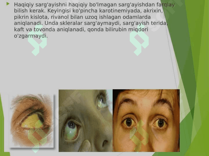 JIGAR VA O'T YO'LLARI SISTEMASI SINDROMLARI. 6