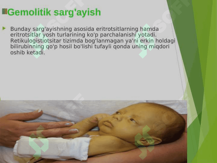 JIGAR VA O'T YO'LLARI SISTEMASI SINDROMLARI. 7