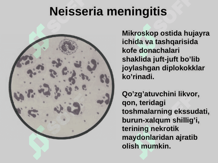 meningokokk 4