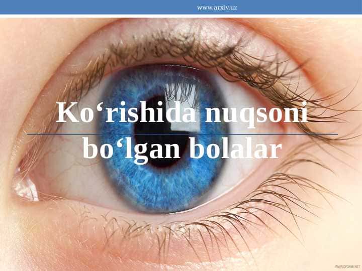 Ko‘rishida nuqsoni bo‘lgan bolalar 1