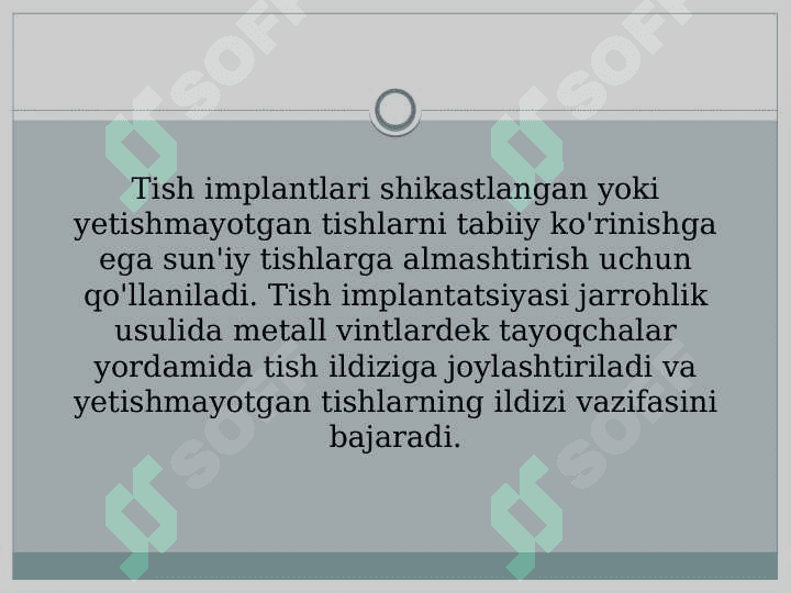 Tish implantlari  tasnifi 3