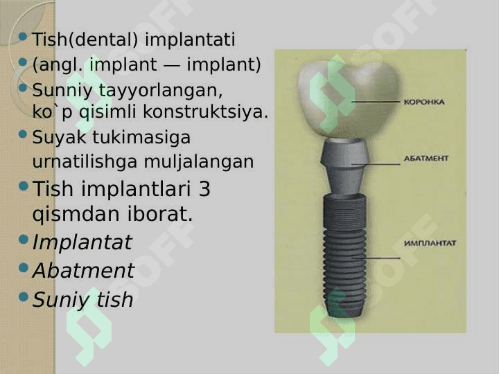 Tish implantlari  tasnifi 4