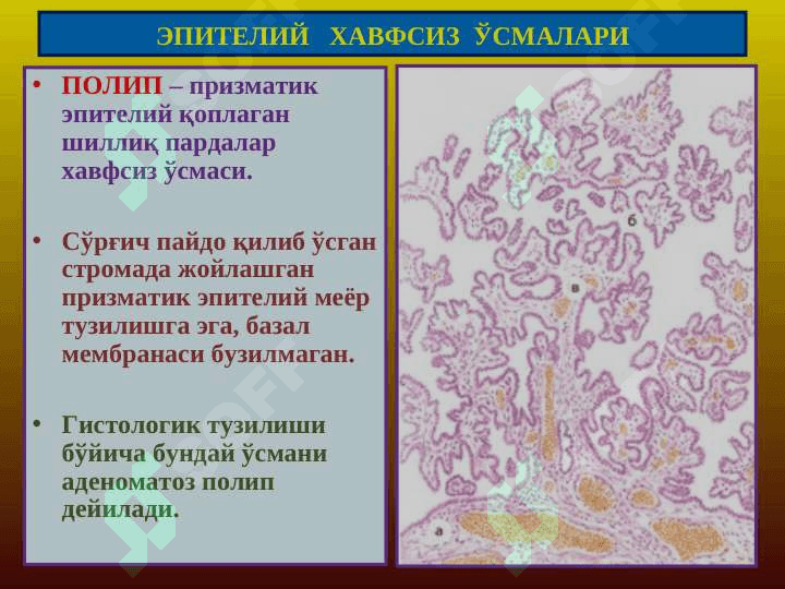 Mezenxemal o`smalar / Мезенхемал усмалар 4