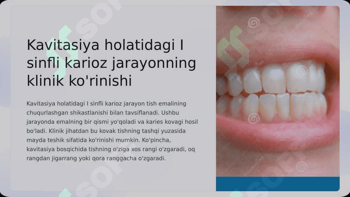 Blek bo‘yicha I - II  sinfli karies  kovaklarini  restavratsiya  qilishning klinik  tamoyillari. 3