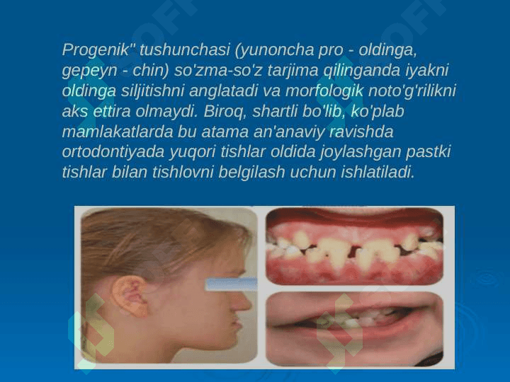 Progenik prikus 2