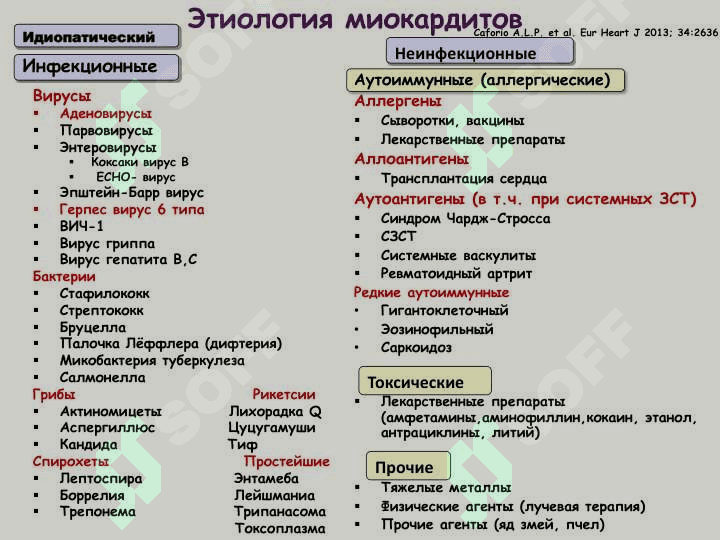 Миокардит 5