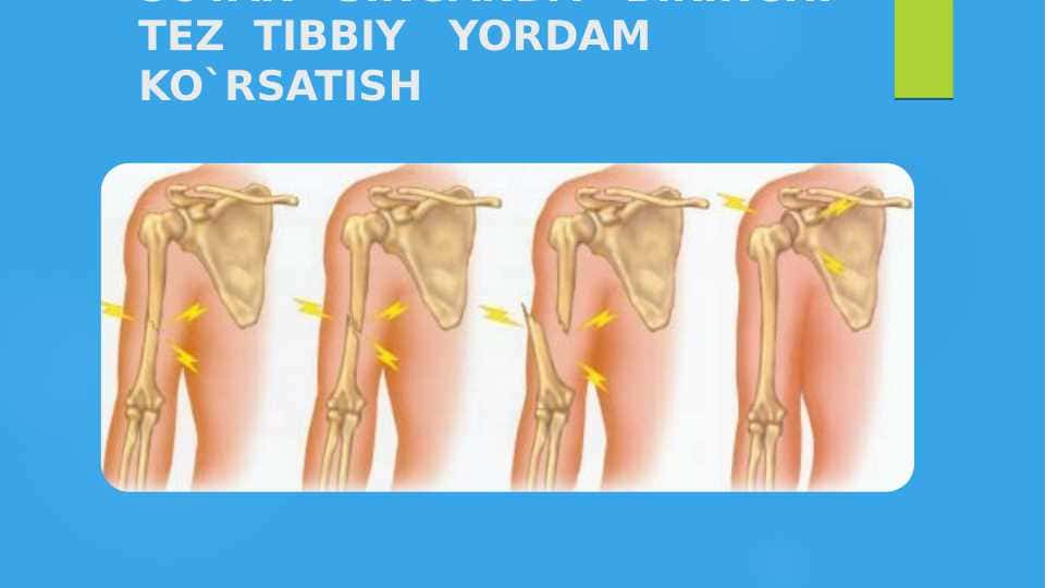 SUYAK   SINGANDA   BIRINCHI  TEZ  TIBBIY   YORDAM KO`RSATISH