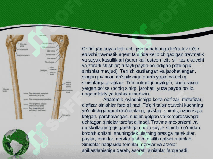 Suyak singanida birinchi yordam ko’rsatish 3