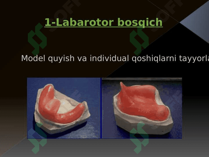 To'liq olib qo'yiladigan tish protezlarni tayyorlashda klinik-laborator bosqichlar. 4