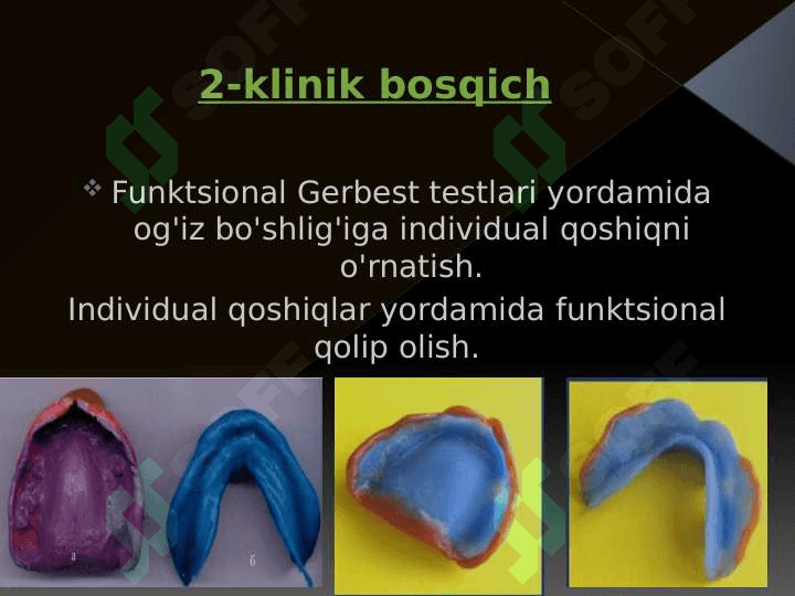 To'liq olib qo'yiladigan tish protezlarni tayyorlashda klinik-laborator bosqichlar. 5