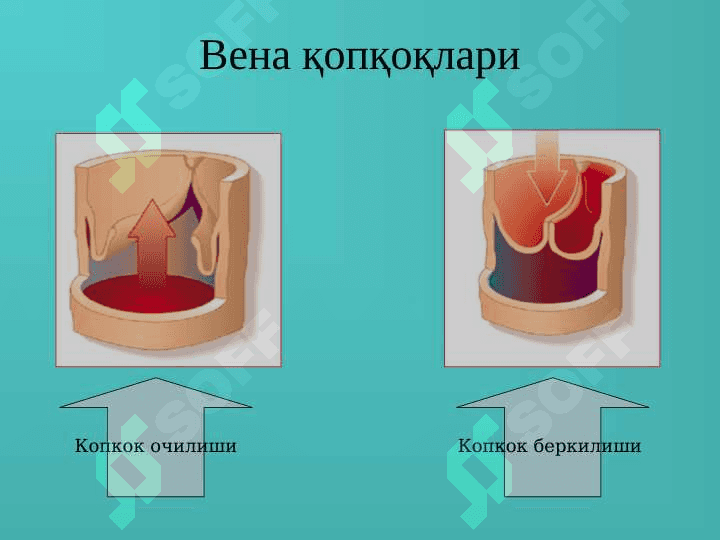 Varikozlar 4