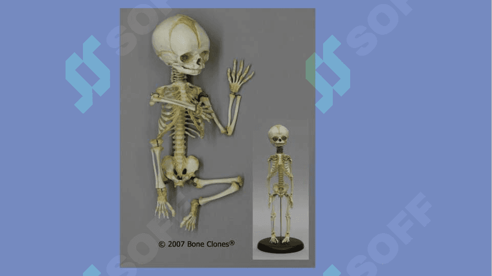 Bolalarda suyak tizimini anatomo – fiziologik hususiyatlari. Skeletni usishi va shakillanishi. Suyak usti pardasini hususiyatlari. 4