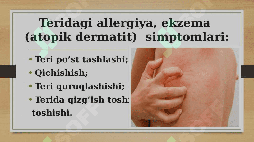 Allergiya 7