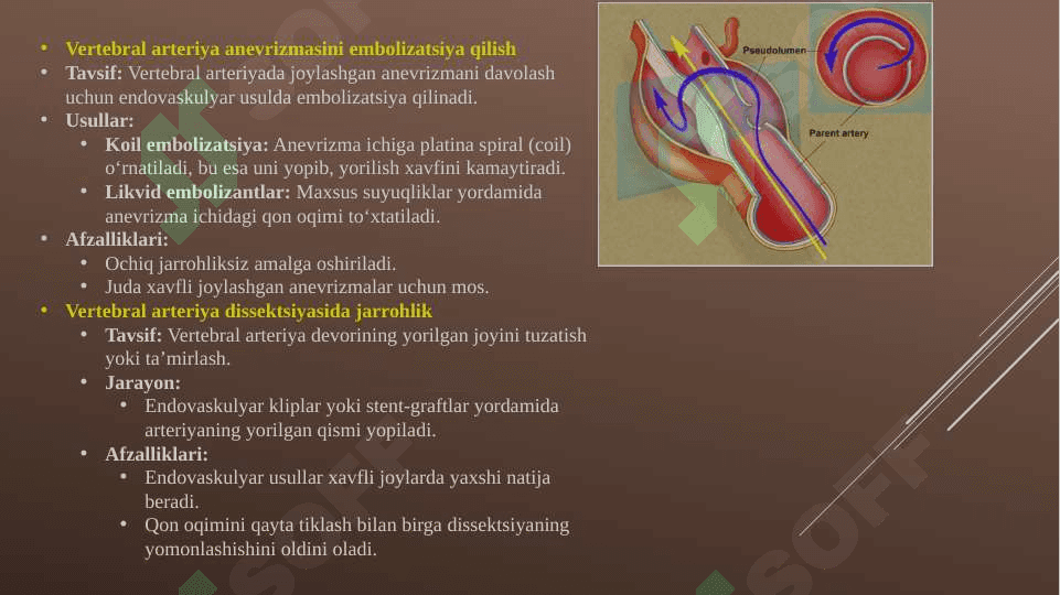 Vertebral arteriyada zamonaviy operatsiyalar 4