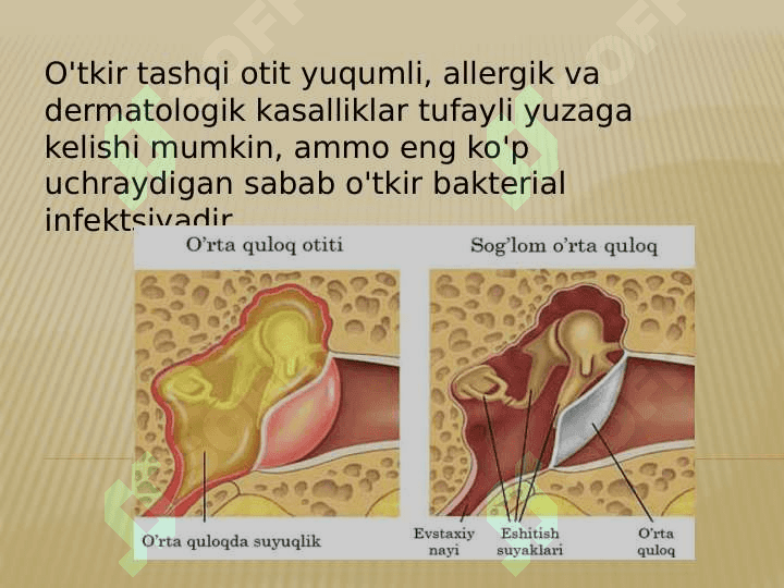 Xavfli tashqi otit 2
