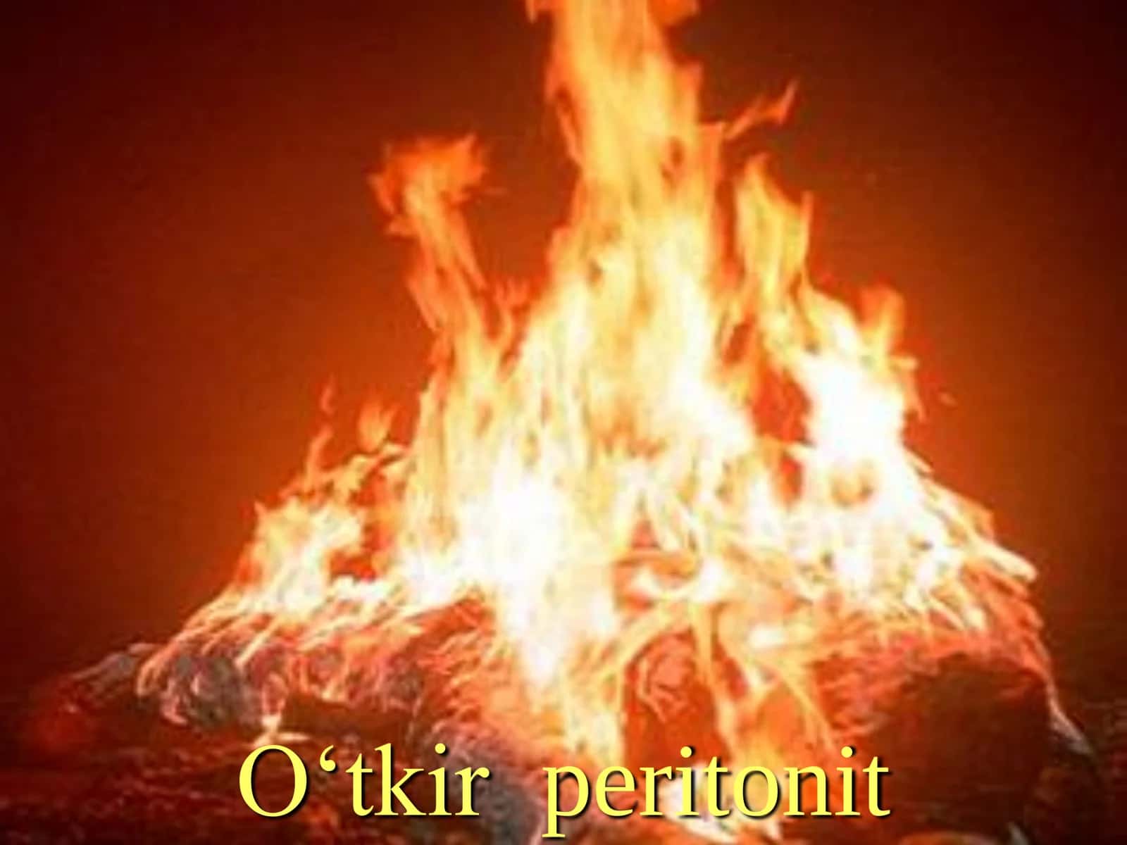 O‘tkir peritonit 1