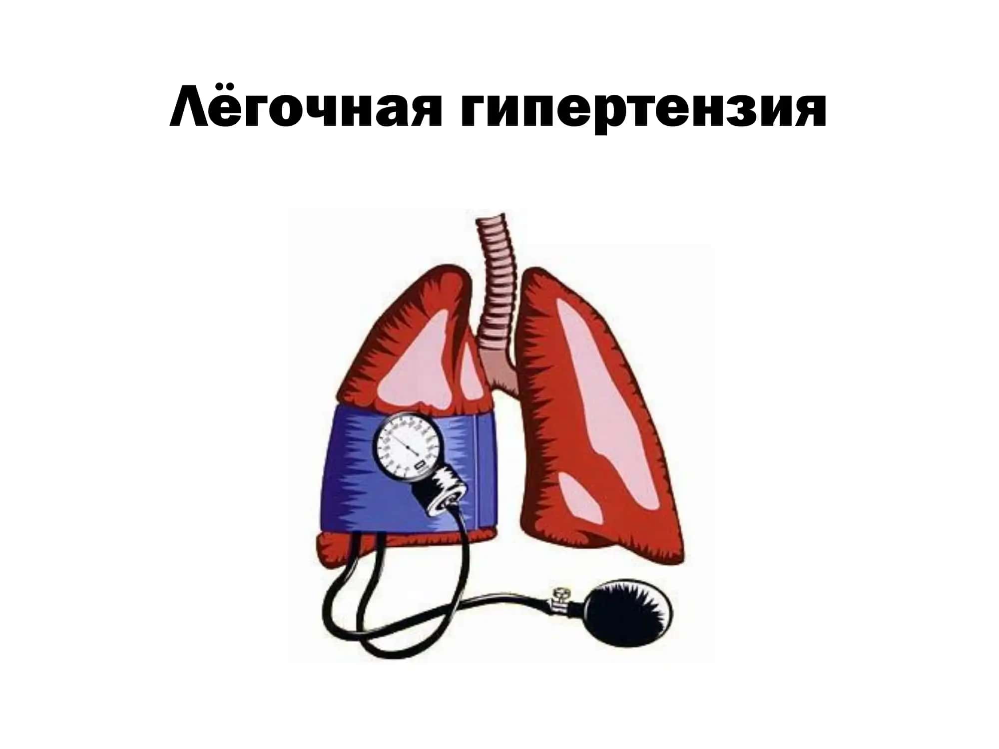 Первичная лёгочная гипертензия 1