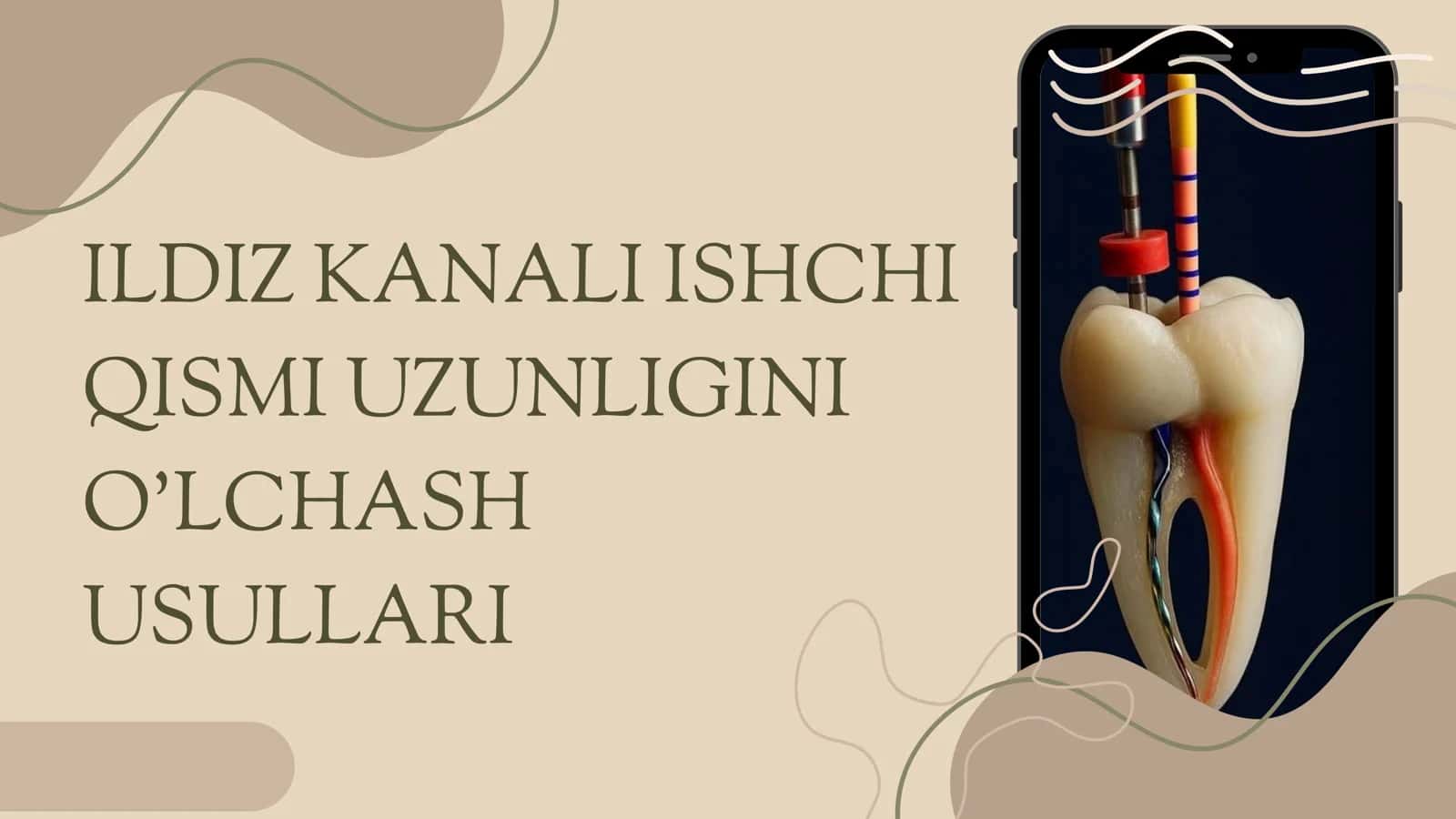Ildiz kanali ishchi qismi uzunligini olchash usullari 1