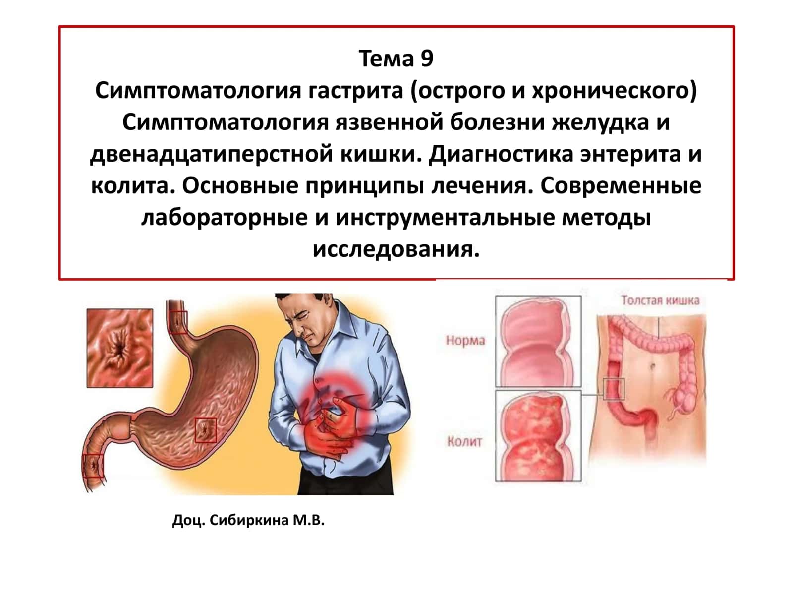Гастрит 1