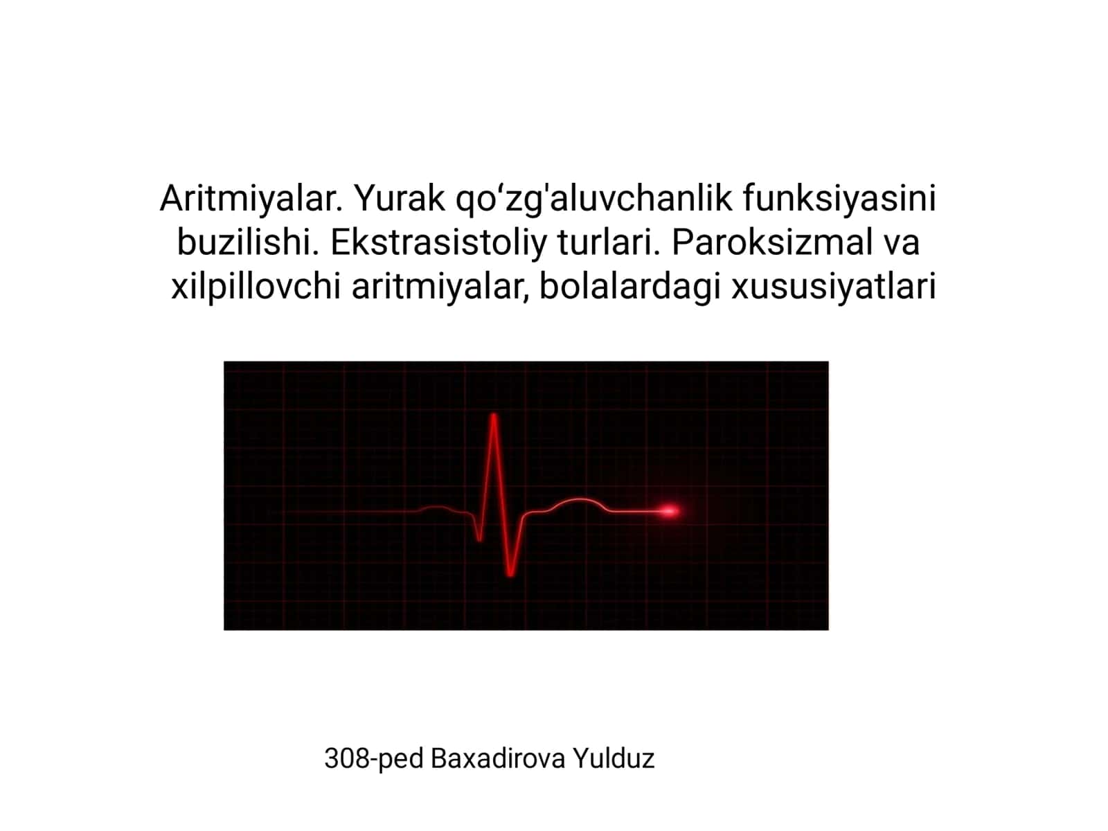 Aritmiyalar. Yurak qoʻzg'aluvchanlik funksiyasini buzilishi. Ekstrasistoliy turlari. Paroksizmal va xilpillovchi aritmiyalar, bolalardagi xususiyatlari 1
