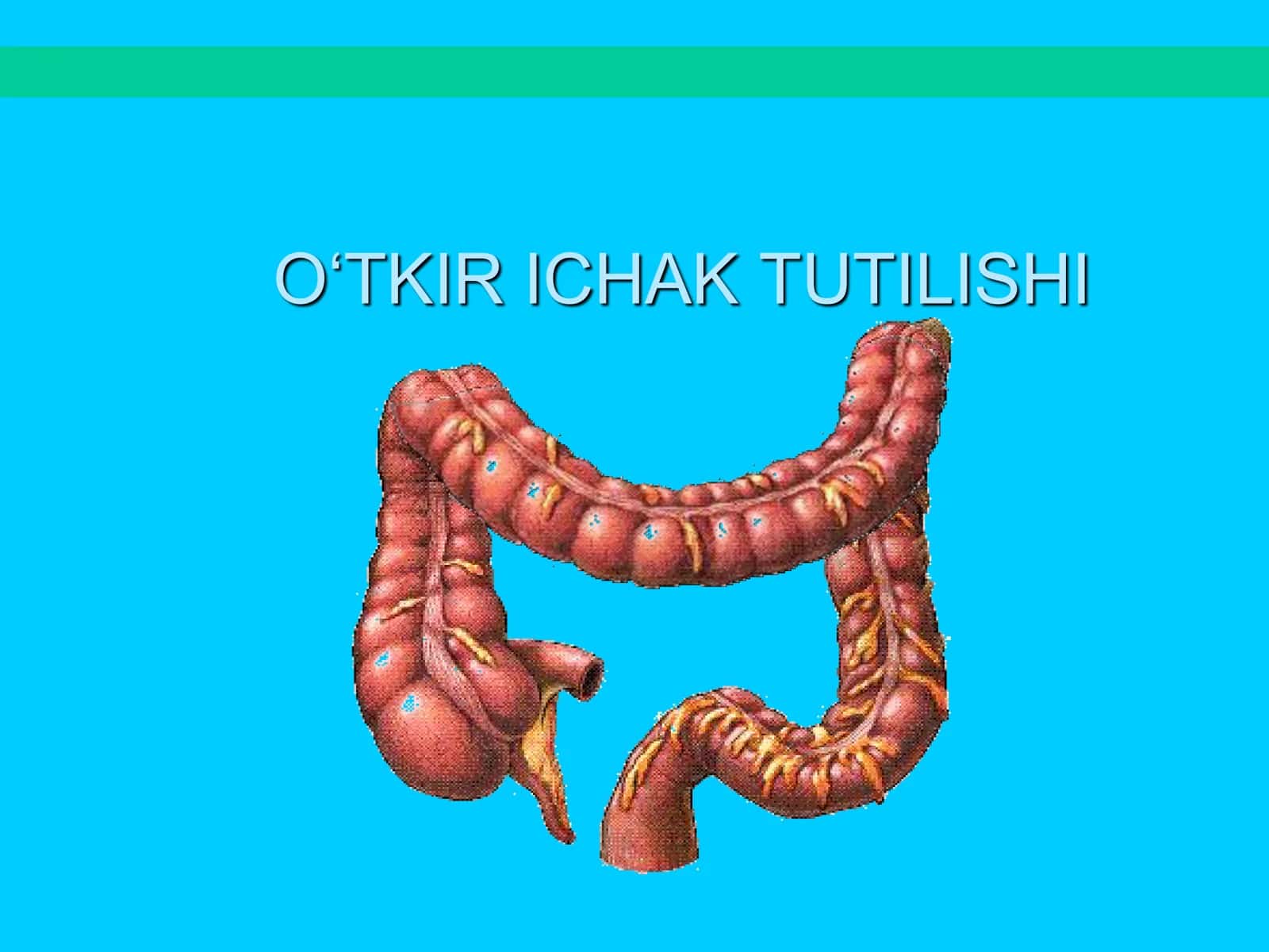 Ichak tutilishi 1