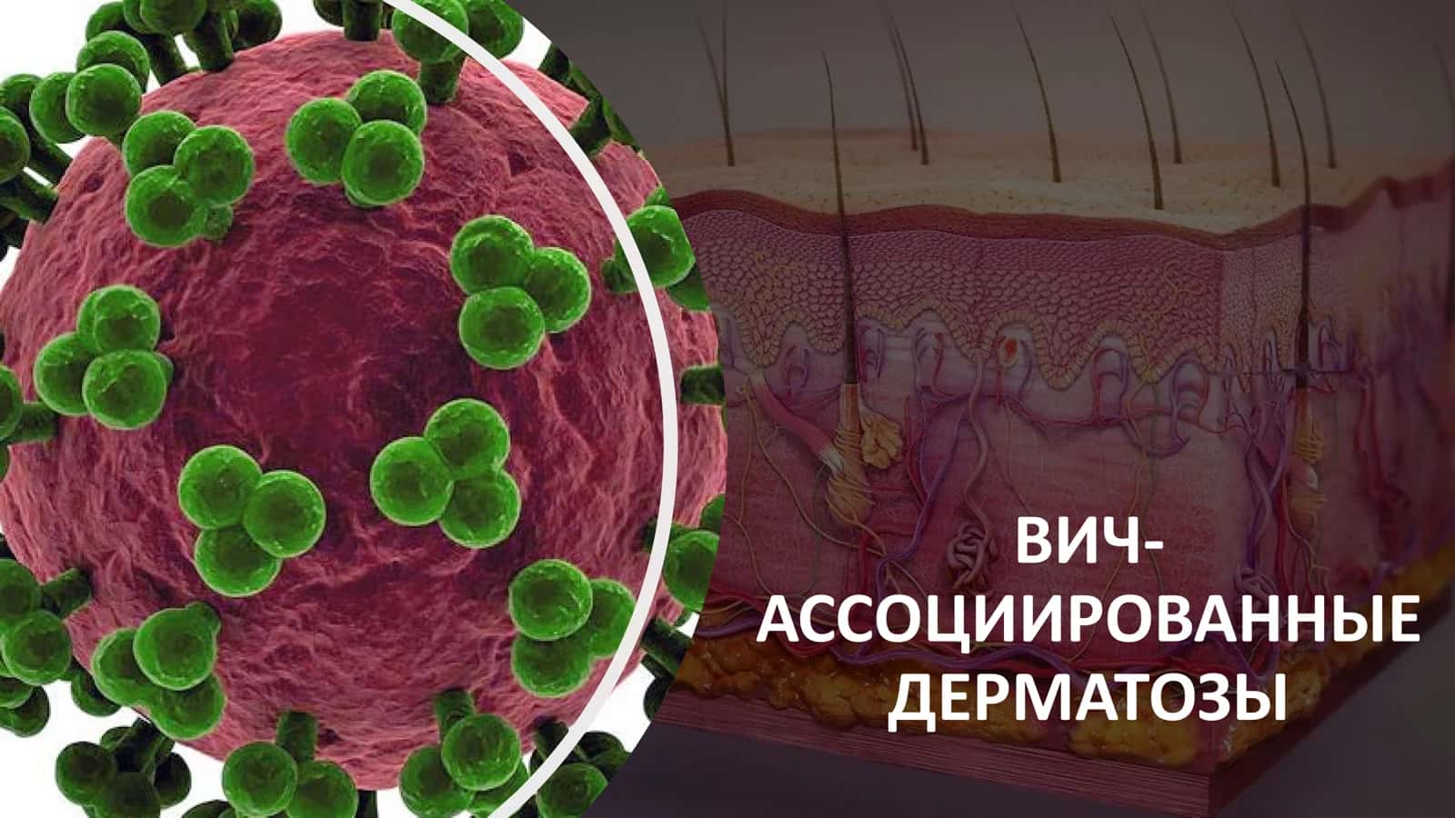 ВИЧ-АССОЦИИРОВАННЫЕ ДЕРМАТОЗЫ 1