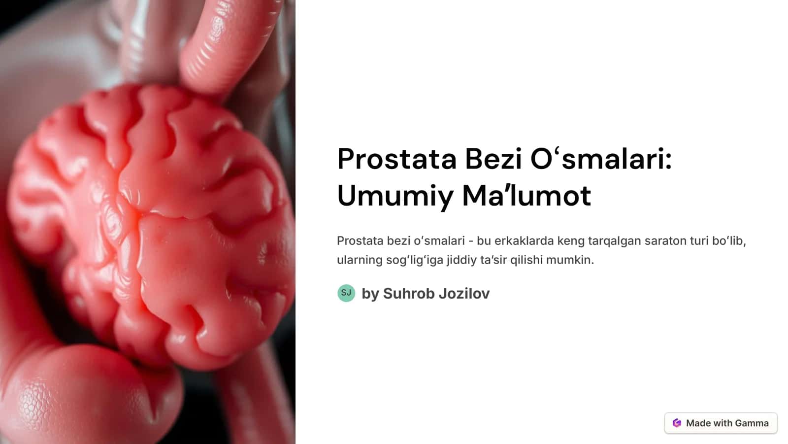 Prostata Bezi Oʻsmalari 1