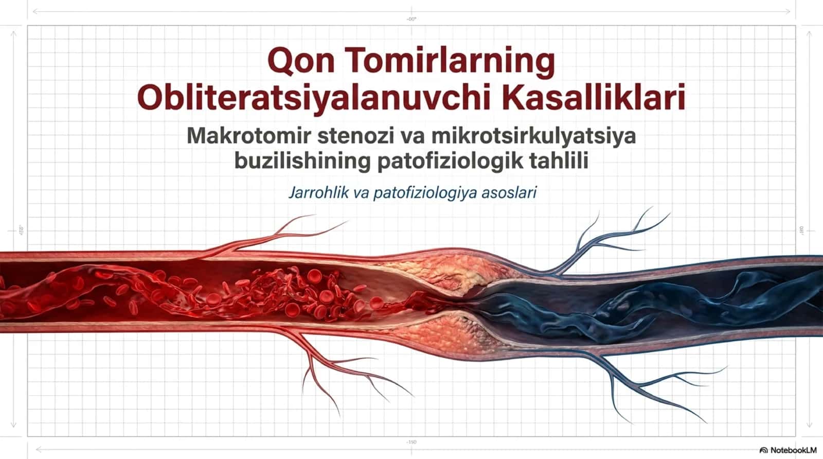 Obliteratsiyalovchi tomir kasalliklari 1