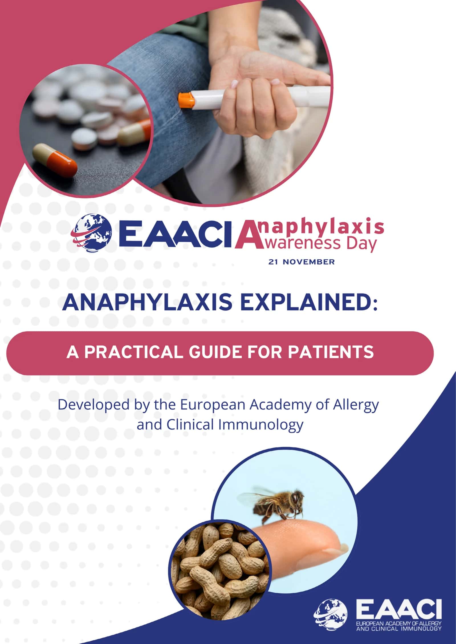 Anaphylaxis Анафилакция 1