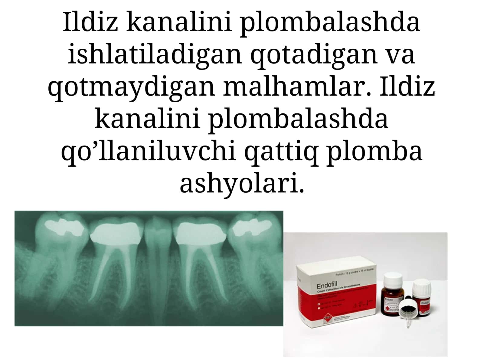 Ildiz kanalini plombalash 1