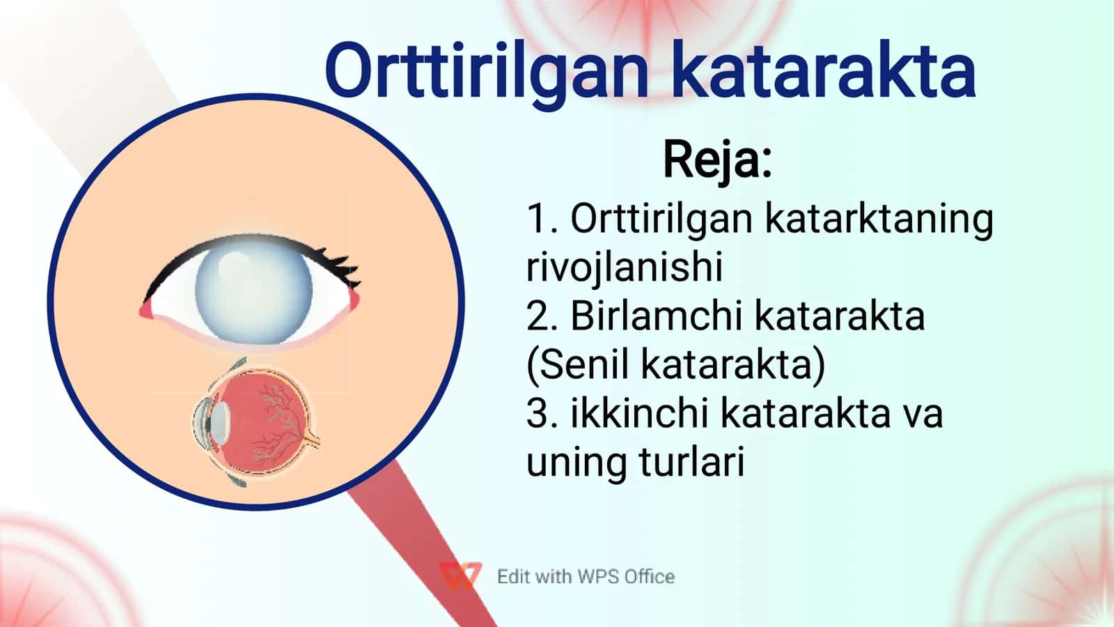 Orttirilgan katarakta 1