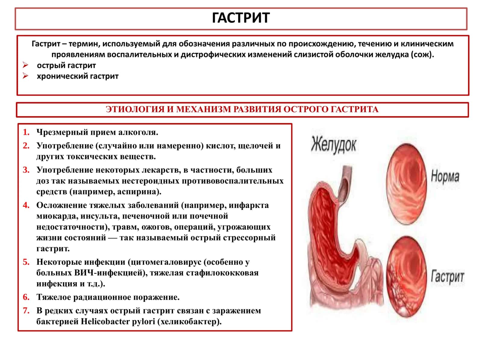 Гастрит 2
